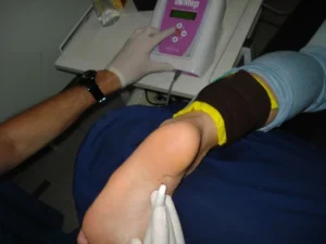 CIMYR - MicroElectrólisis Percutánea (MEP)